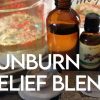 Sunburn Relief Lavender Oil Blend